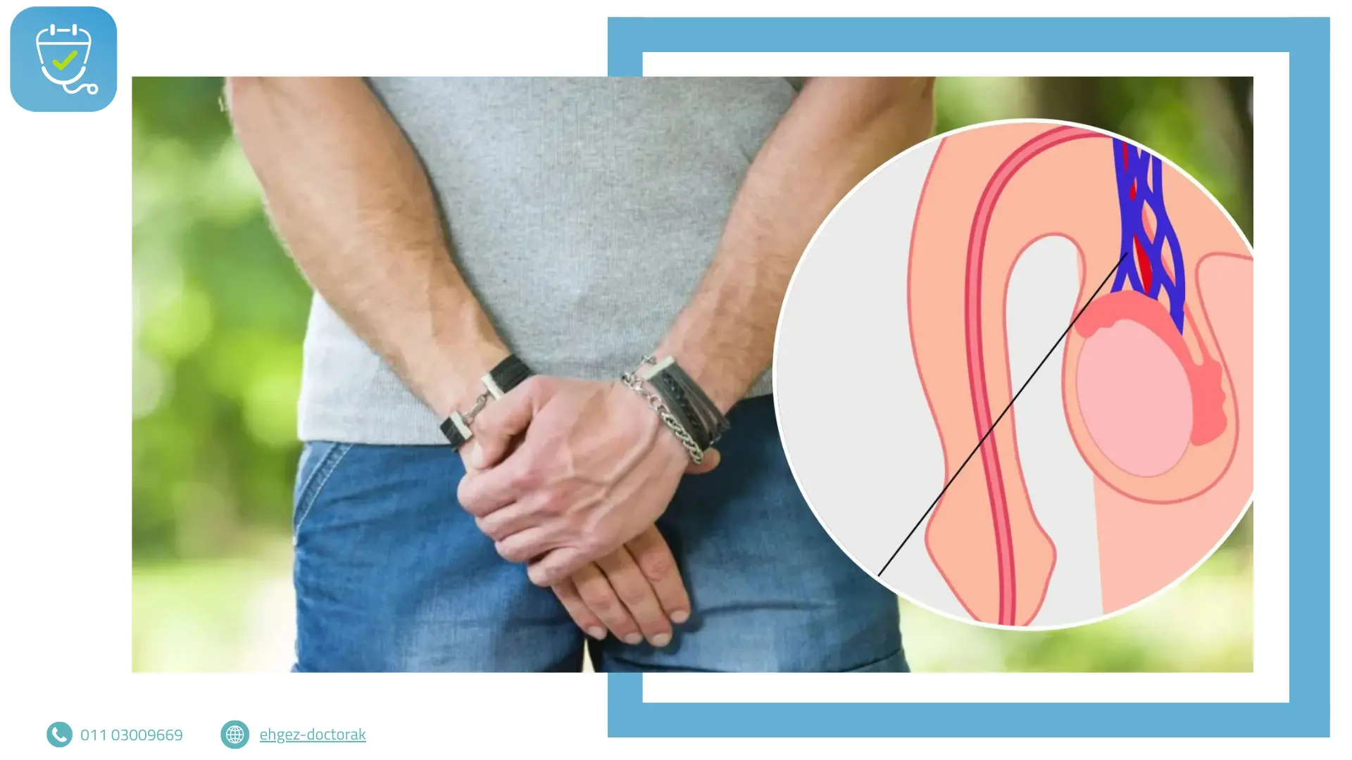 دوالي الخصية