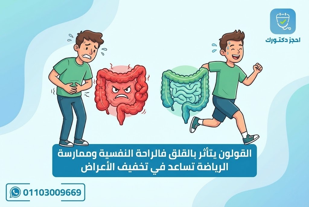 رسم توضيحي لمتلازمة القولون العصبي يوضح مكان القولون والألم في البطن